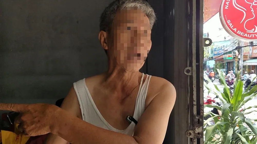 Theo ông H, nhóm này chém nhiều nhát trúng xe máy, ném gạch đá, hung khí vào nhà. Ảnh: HT