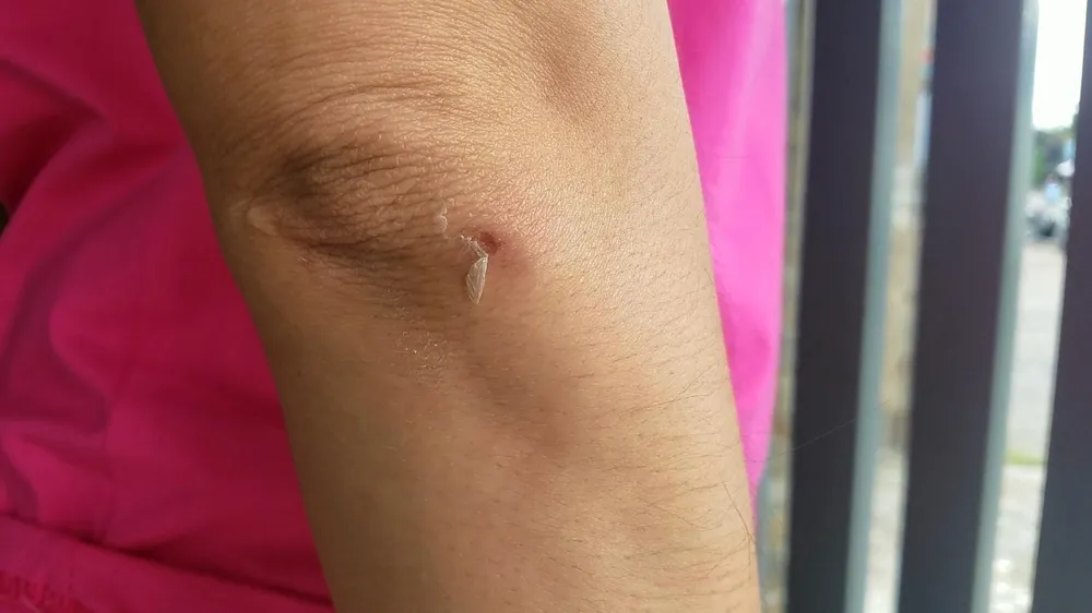 Vụ việc khiến chị Y xây xát nhẹ. Ảnh: HT Vụ việc khiến chị Y xây xát nhẹ. Ảnh: HT