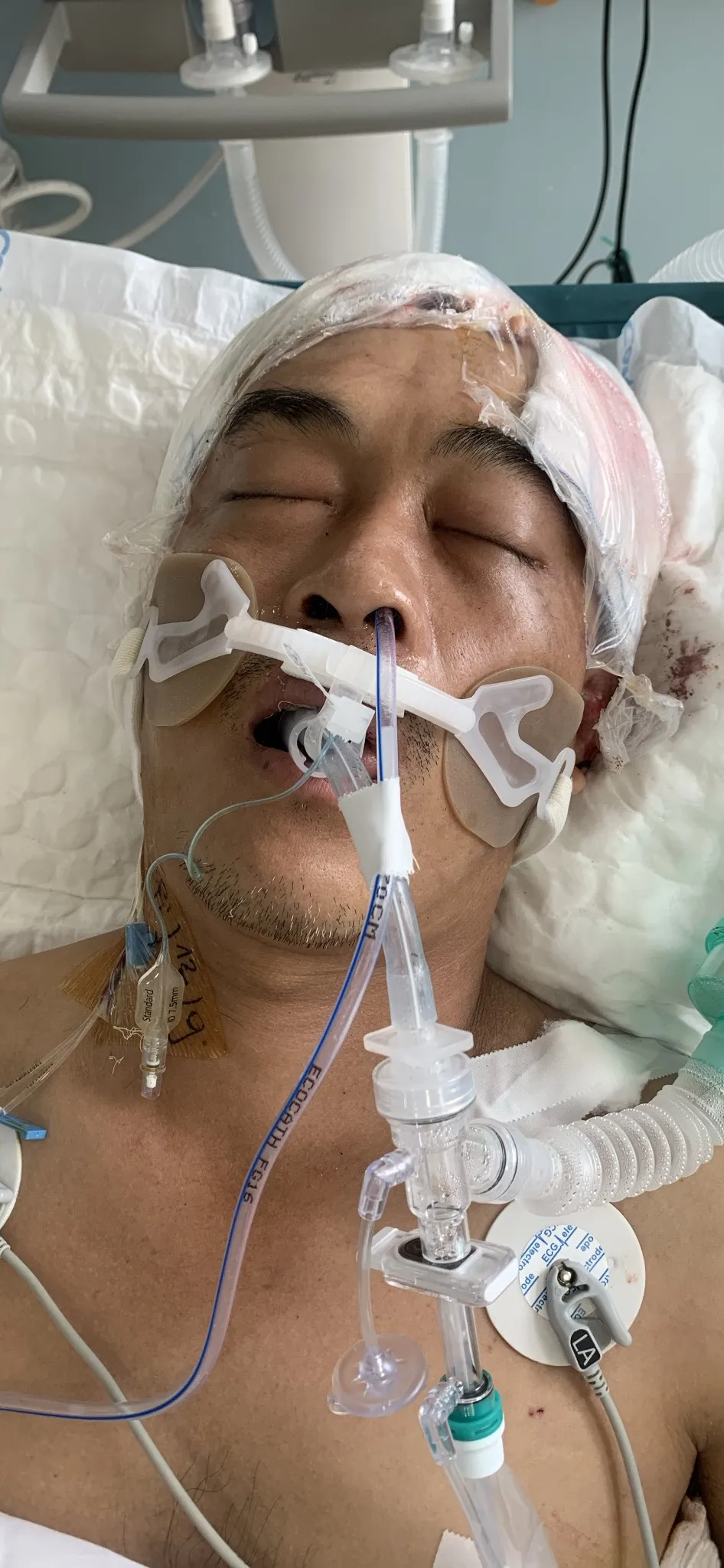 Công an hiện đang tìm thân nhân của người đàn ông bị thương trong vụ tai nạn giao thông ở quận 12. Ảnh: CA