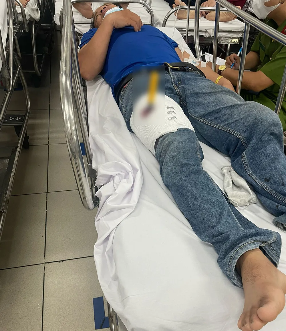 Vụ tài xế xanh SM bị cướp đâm dao vào chân là tự đâm để dối vợ