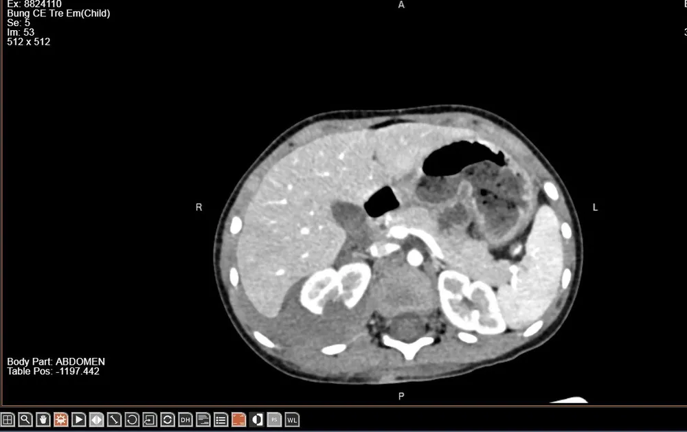 Bé 3 tuổi vỡ thận do bị chó béc-giê tấn công 2.jpg