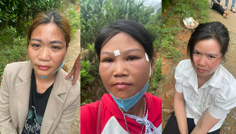 Nhóm phụ nữ tàng trữ ma túy. Ảnh CACC Ba viên đất 'lạ' dưới chân nhóm phụ nữ rủ nhau uống rượu giữa chiều 2.jpg