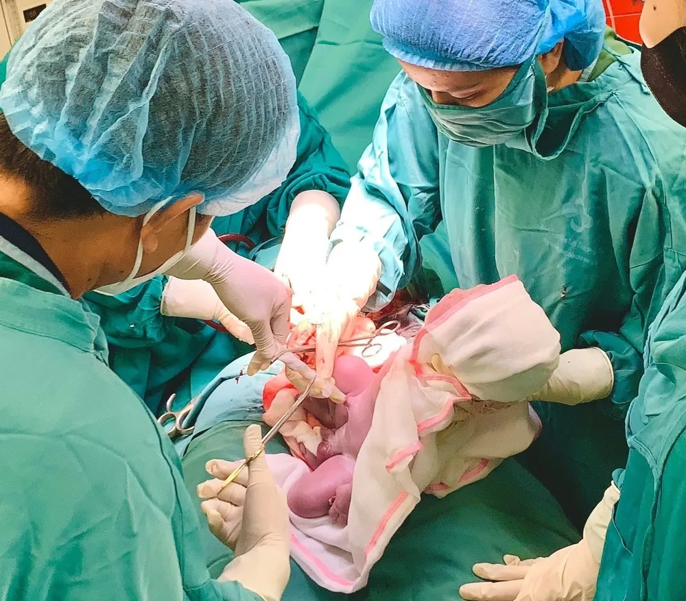 Một trong hai bé chào đời cùng vòng tránh thai của mẹ. Ảnh BVCC 2 em bé chào đời cùng vòng tránh thai của mẹ.jpg