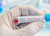 Pfizer: Sẽ ra mắt loại vaccine nhắm vào Omicron trong tháng 3 ảnh 2 Các hãng dược phát triển vaccine đặc biệt ngừa biến thể Delta
