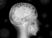 Báo động xu hướng tự làm mình nhiễm COVID-19 ảnh 2 Chứng sương mù não: Virus SARS-CoV-2 đã làm gì với não bộ bệnh nhân COVID-19?