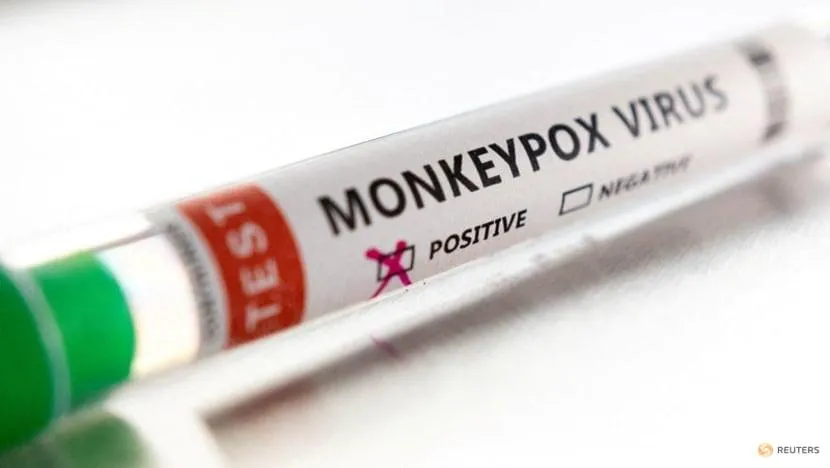 Ống nghiệm có nhãn "Dương tính với virus đậu mùa khỉ" được chụp vào ngày 22-5. Ảnh: REUTERS Ống nghiệm có nhãn "Dương tính với virus đậu mùa khỉ" được chụp vào ngày 22-5. Ảnh: REUTERS