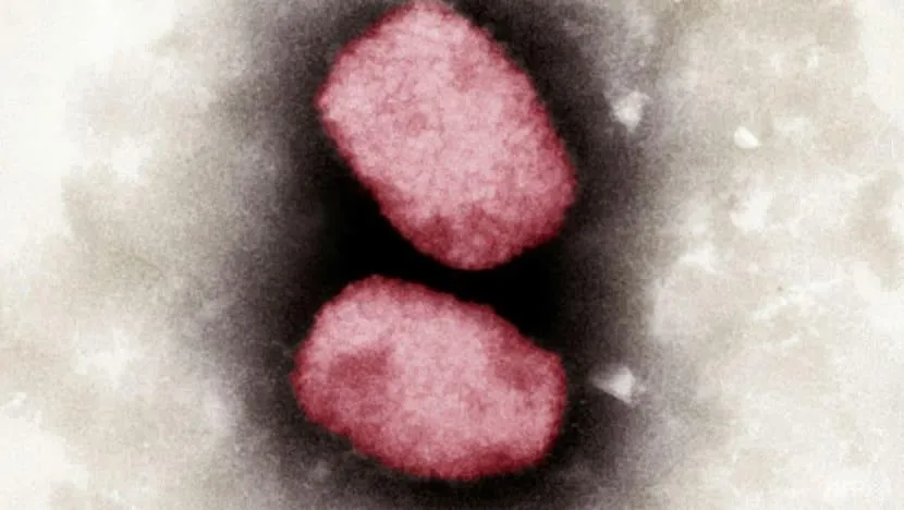 Bức ảnh chụp virus đậu mùa khỉ bằng kính hiển vi điện tử. Ảnh: AFP Bức ảnh chụp virus đậu mùa khỉ bằng kính hiển vi điện tử. Ảnh: AFP