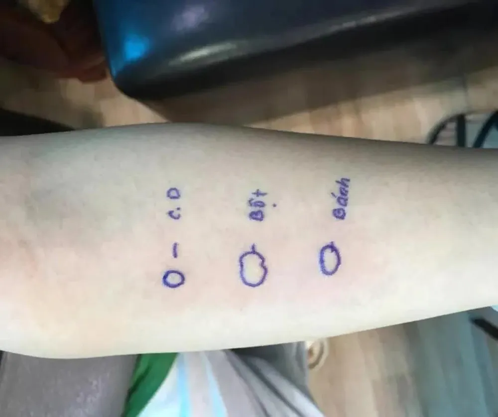 Hình ảnh test cho thấy cô gái có phản ứng với bột bánh mì. Ảnh: BSCC Hình ảnh test cho thấy cô gái có phản ứng với bột bánh mì. Ảnh: BSCC