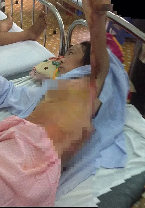 Cha phóng hỏa, 2 mẹ con nhập viện vì bỏng ảnh 2