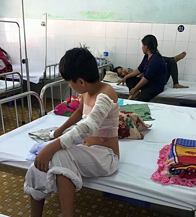 Cha phóng hỏa, 2 mẹ con nhập viện vì bỏng ảnh 1