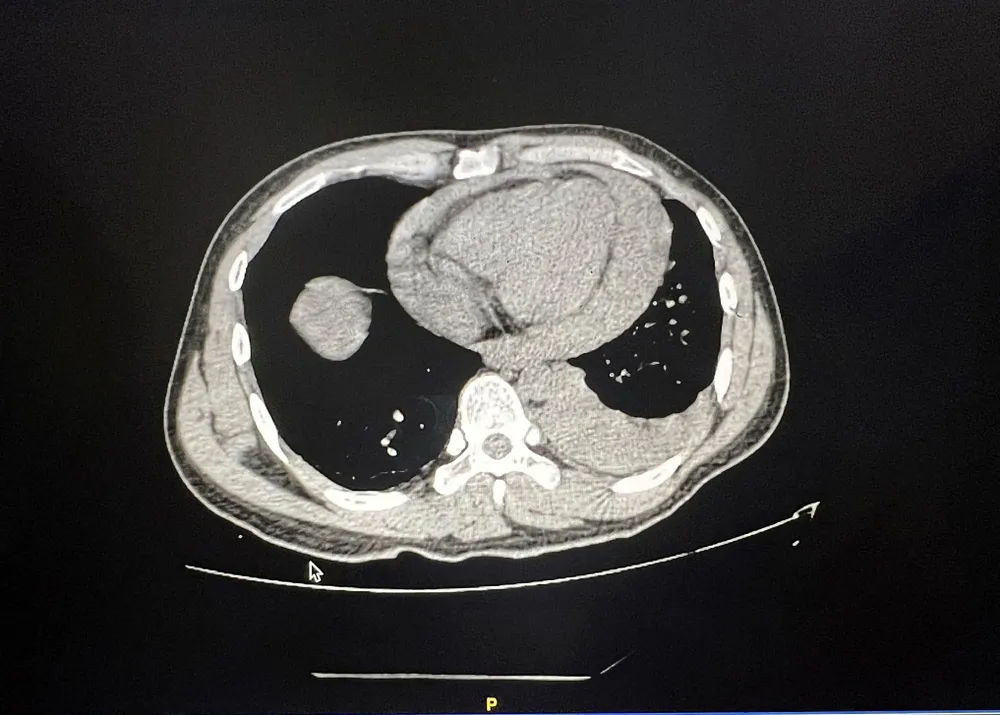 Bệnh viện đã kích hoạt báo động đỏ cứu sống bệnh nhân đang nguy kịch. Ảnh: BVCC
