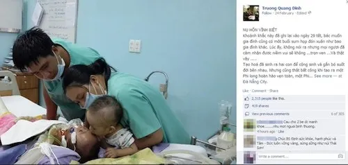 Bức ảnh chụp hai bé hôn nhau trên giường bệnh với tựa đề 'Nụ hôn vĩnh biệt' được Bác sĩ Trương Quang Định- người trực tiếp thực hiện ca phẫu thuật tách rời 2 bé sơ sinh dính liền tim gan đăng tải trên Facebook cá nhân của mình ngày 24/2.