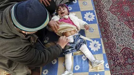 syria, chiến tranh, y tế, thuốc mê