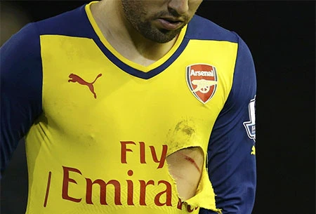 Hậu quả trên người Cazorla sau cú đạp của Borini