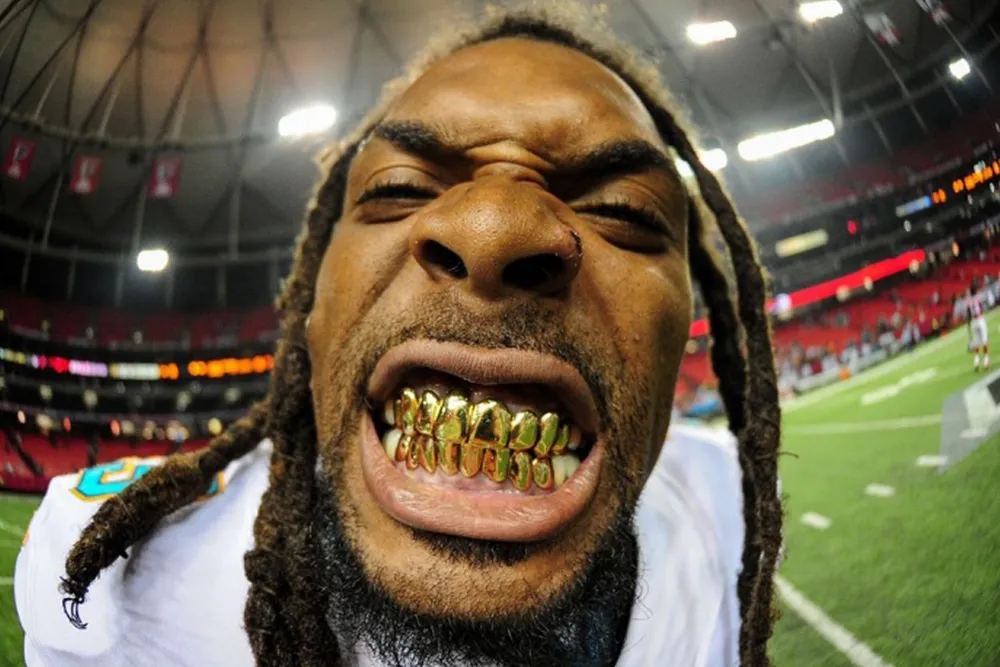 Những hình ảnh hài hước, khó quên nhất làng thể thao năm 2014 ảnh 7 Những hình ảnh hài hước, khó quên nhất làng thể thao năm 2014 ảnh 7