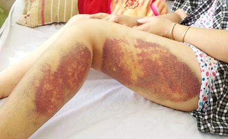 Đưa nữ công nhân bị công an đánh đi giám định thương tích ảnh 1