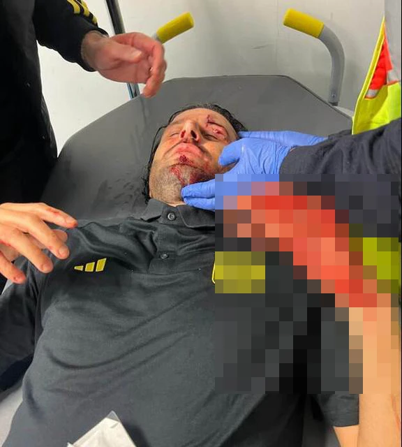 HLV Fabio Grosso đang được bác sĩ chữa trị. Ảnh: S.E hlv-bi-tan-cong.jpeg