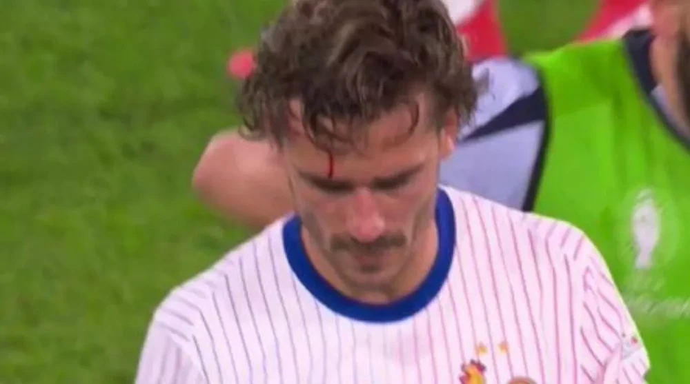 Griezmann rời sân cho bác sĩ đội tuyển Pháp tiếp tục chăm sóc. ẢNH: ITV doi-tuyen-phap-Griezmann.jpg