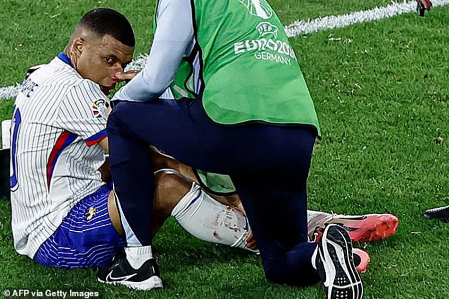 Mbappe bị gãy mũi trong trận Pháp thắng Áo 1-0. ẢNH: GETTY mbappe-gay-mui.jpg