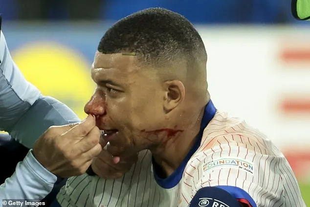 Ninja rùa Mbappe dính chấn thương ở mũi khá nặng. ẢNH: GETTY euro-2024-kylian-mbappe.jpg