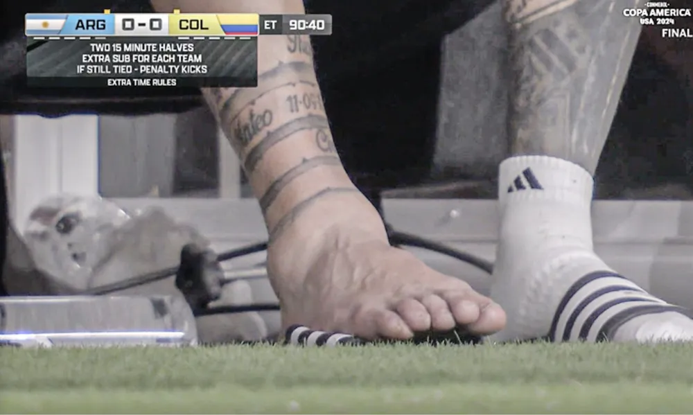Mắt cá chân của tiền đạo 37 tuổi sưng tấy sau khi chấn thương. Ảnh: ESPN messi-chan-thuong.png