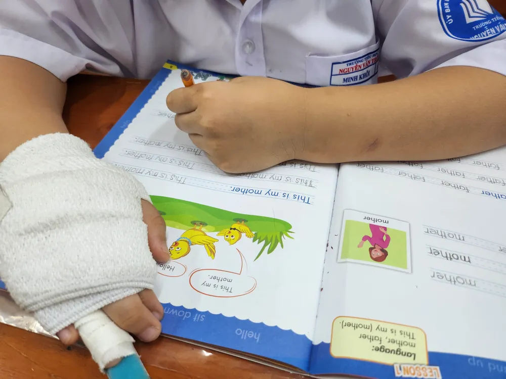 Bị gãy xương ngón tay phải nên bé K đang tập viết bằng tay trái. Ảnh: NGUYỄN QUYÊN tam-dinh-chi-co-giao-1.jpg