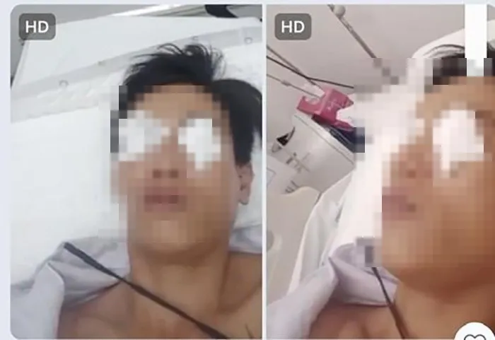 Hai nhân viên phòng kỹ thuật toà nhà bị thương mắt phải nhập viện điều trị. Ảnh: Cắt từ clip hon-chien-quan-7-2441-3535.jpg