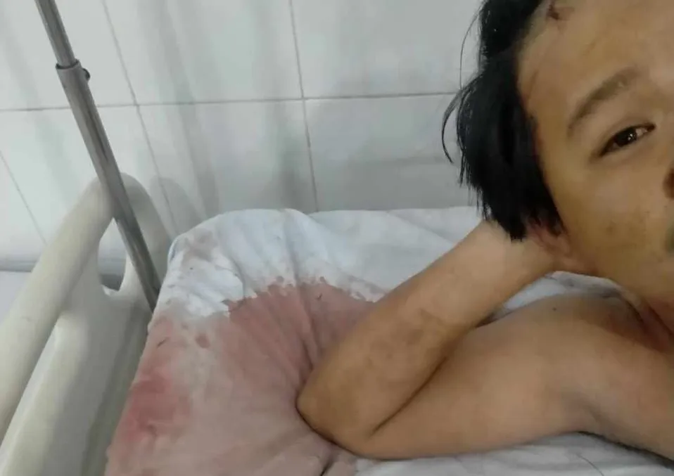 Anh NL nằm viện điều trị sau khi bị nhóm người hành hung. Ảnh: CTV 5 người xông vào nhà trọ hành hung 2 người tại TP Thủ Đức