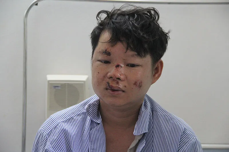 Phụ xe Nguyễn Long Giang bàng hoàng kể lại diễn biến vụ tai nạn. Ảnh: MINH KHÔI Phụ xe Nguyễn Long Giang bàng hoàng kể lại diễn biến vụ tai nạn. Ảnh: MINH KHÔI