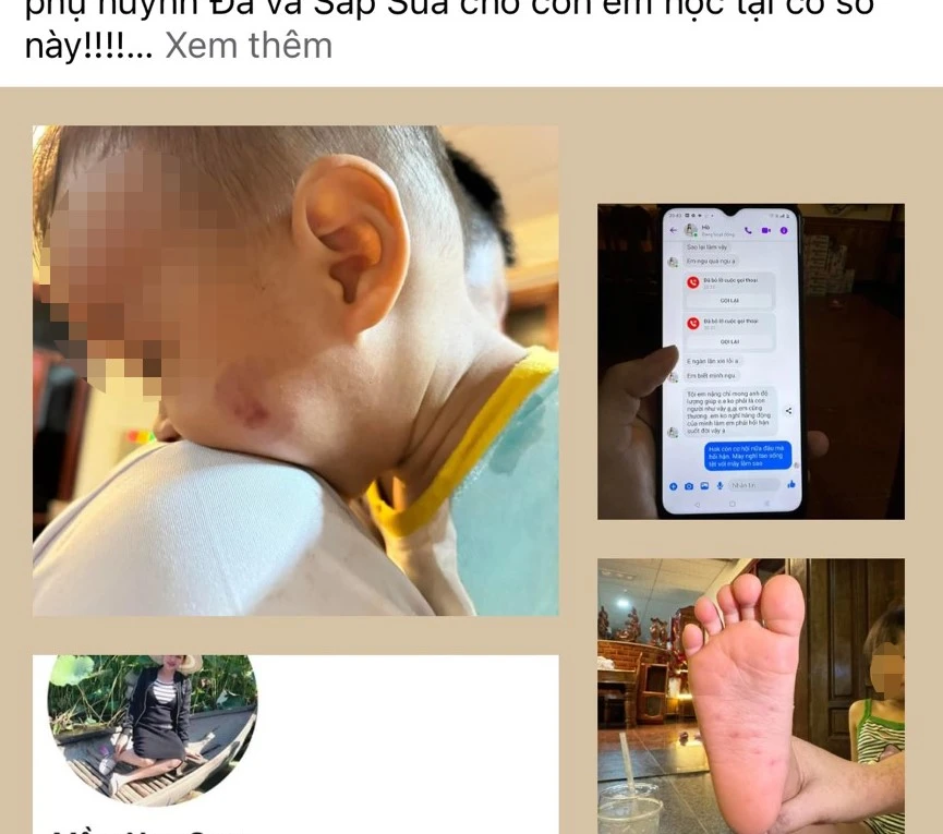 Người nhà chia sẻ thông tin lên mạng xã hội về việc cháu bé đi học nghi bị bạo hành. Ảnh TD trẻ.jpg