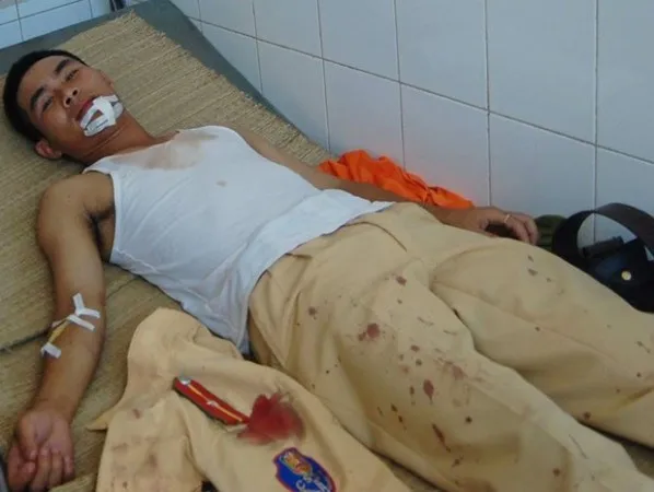 Dũng cảm cứu người, thiếu úy CSGT bị côn đồ chém ảnh 1