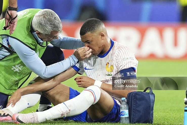 Mbappe chấn thương cả đội Pháp lo lắng. Ảnh: GETTY IMAGES mbappe-khong-phai-phau-thuat-nhung-can-deo-mat-na-thi-dau-Mbappe 2.jpg