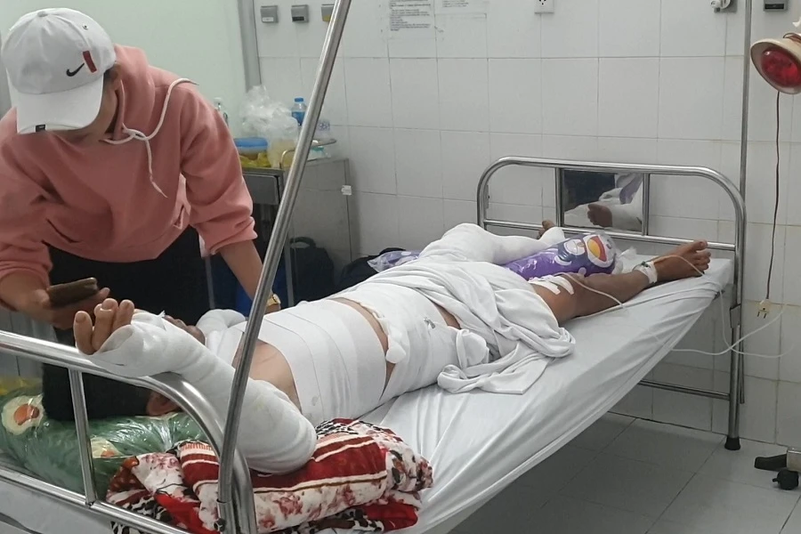 Các nạn nhân trong vụ nổ ghe lưới ghẹ ở Cà Mau đang được điều trị tại Bệnh viện đa khoa tỉnh này. Ảnh: CTV ngu-dan-bi-thuong-trong-vu-no-ghe-luoi-ghẹ-ca-mau1.jpg