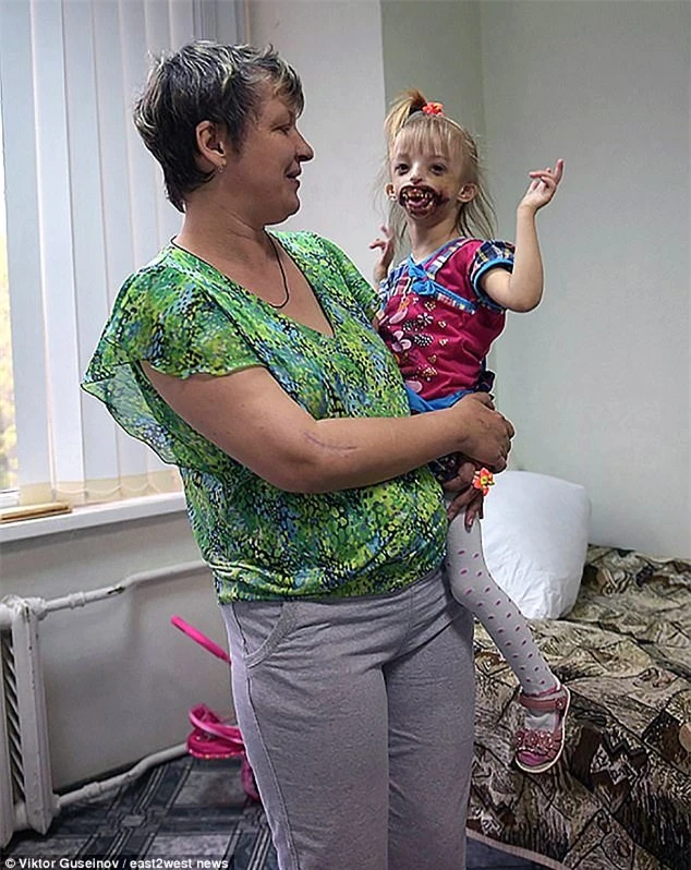 Bé gái bị xa lánh vì mắc dị tật miệng quỷ - Ảnh 1.