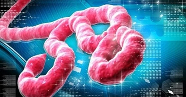 Miễn phí điều trị nếu mắc bệnh Ebola tại Việt Nam