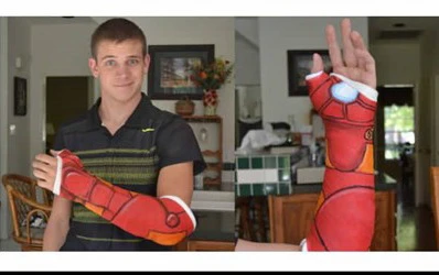 Nghệ thuật trên những cánh tay gãy ảnh 10