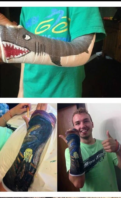 Nghệ thuật trên những cánh tay gãy ảnh 11