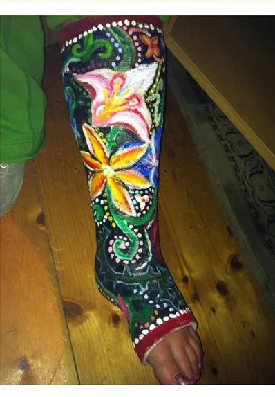 Nghệ thuật trên những cánh tay gãy ảnh 18