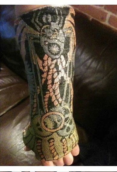 Nghệ thuật trên những cánh tay gãy ảnh 19