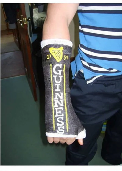 Nghệ thuật trên những cánh tay gãy ảnh 23