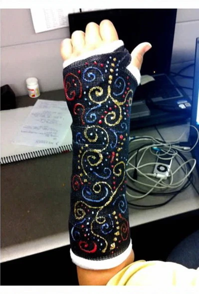 Nghệ thuật trên những cánh tay gãy ảnh 22