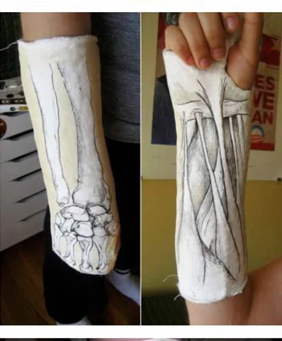 Nghệ thuật trên những cánh tay gãy ảnh 21