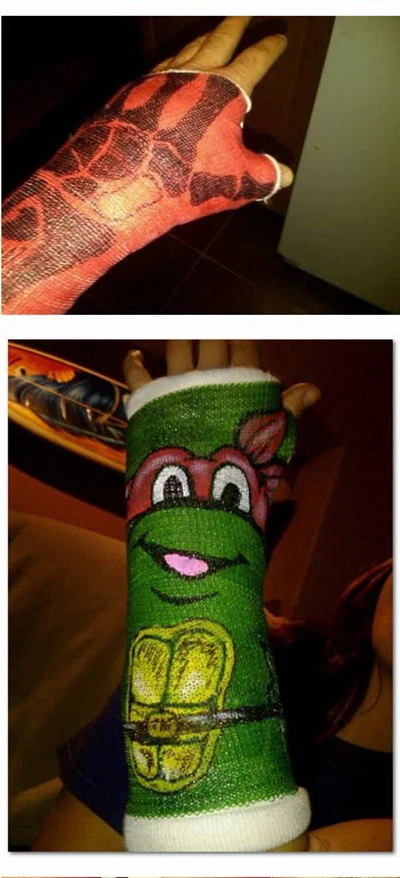 Nghệ thuật trên những cánh tay gãy ảnh 25