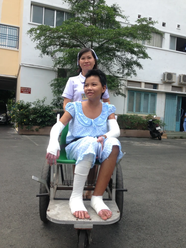 Bé gái bị mẹ tưới xăng đốt cười tươi khi xuất viện ảnh 2