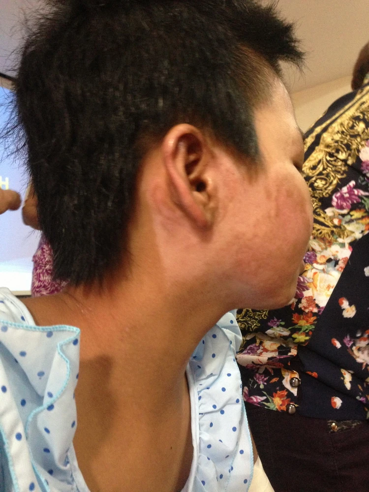 Bé gái bị mẹ tưới xăng đốt cười tươi khi xuất viện ảnh 4