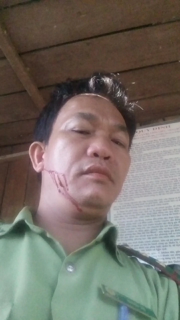 Ông Thà bị chém vào mặt dẫn đến thương tích.