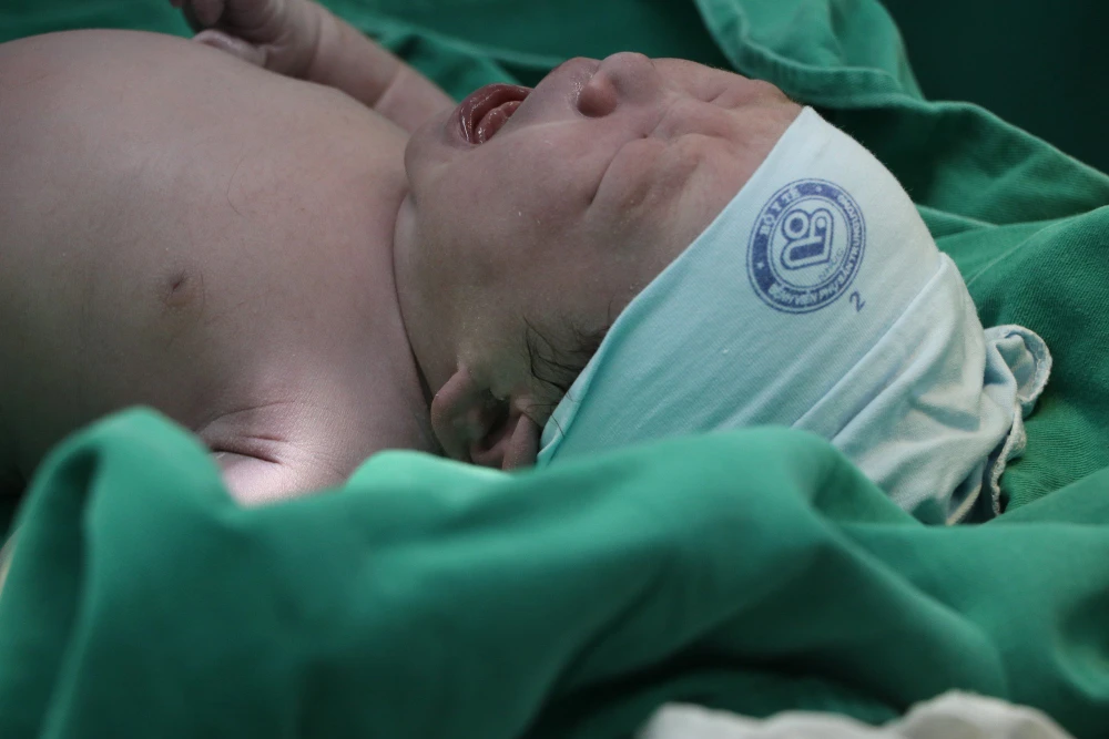 Sau khi chào đời, em bé tỉnh táo, khóc tốt, có nồng độ oxy trong máu thấp. Ảnh: BVCC