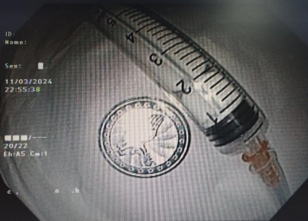 nuốt đồng xu.jpg