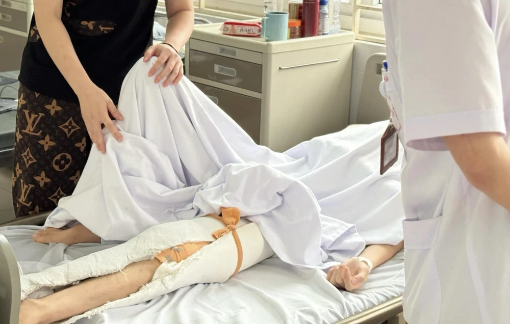 viêm xương tủy.jpg