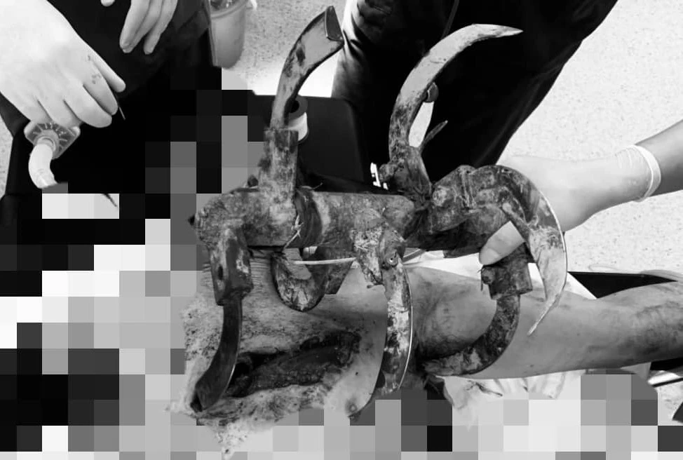 lưỡi cày đâm sâu vào ngực.jpg